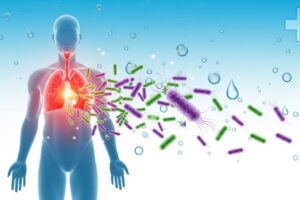 Legionnaires’ Disease