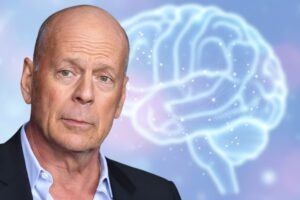 Frontotemporal Dementia, Bruce Willis