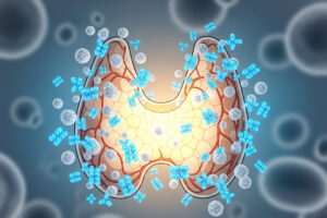 Graves' disease, thyroid illustration